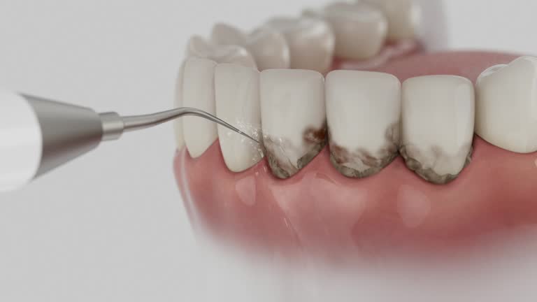 Reliable Dental contractor in Reminderville, OH by Dentist Open Now
